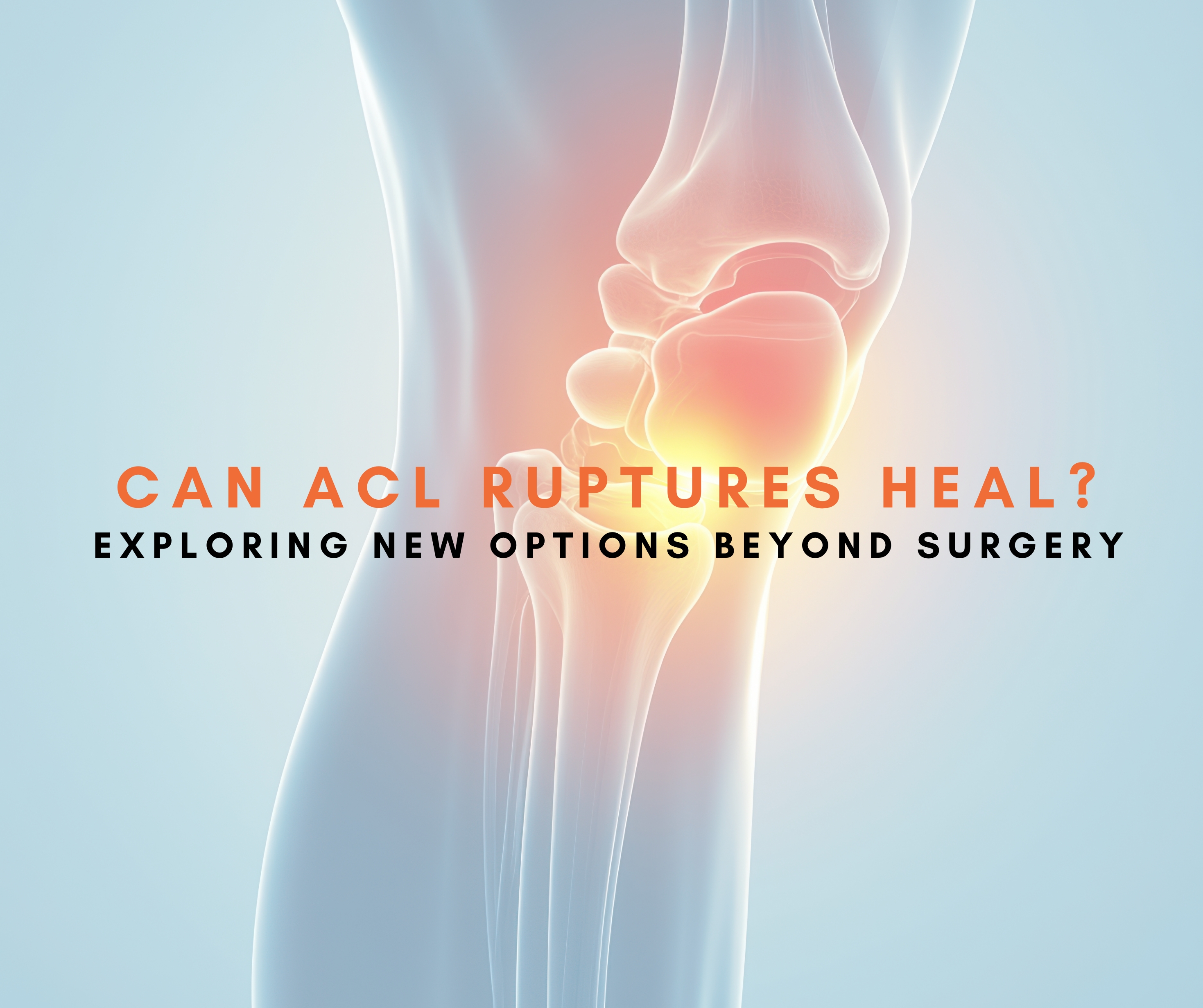 Can ACL Ruptures Heal? Exploring New Options Beyond Surgery
